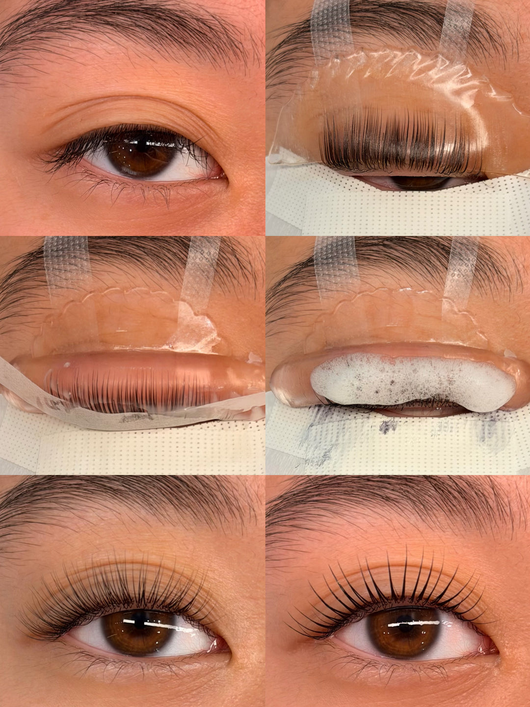 Pristine Cysteamine Lift